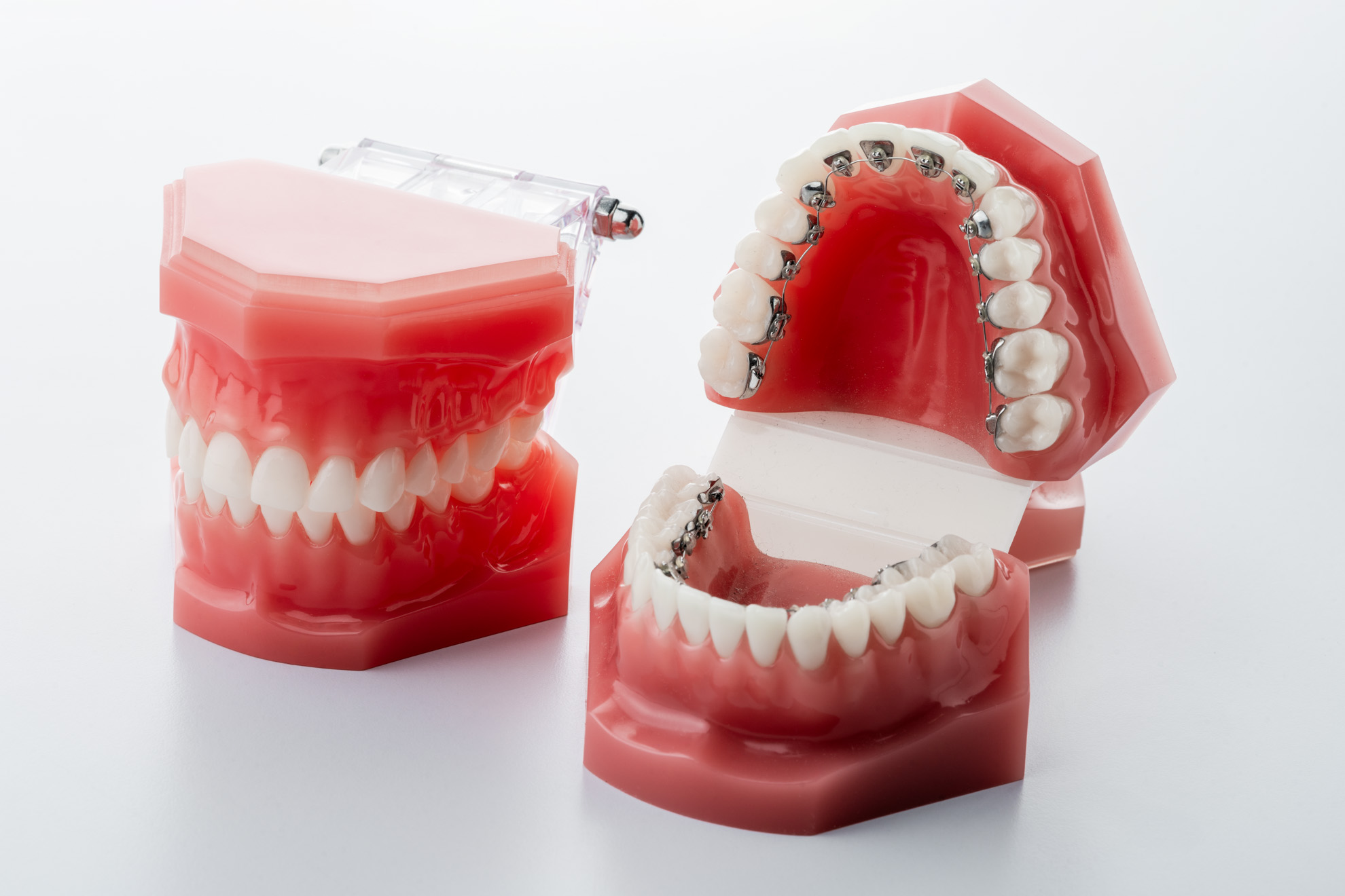 10 Pièces Bases Maille De Retenue Linguale Orthodontie Dentaire Marquées L35 - Neuf SKYSEA